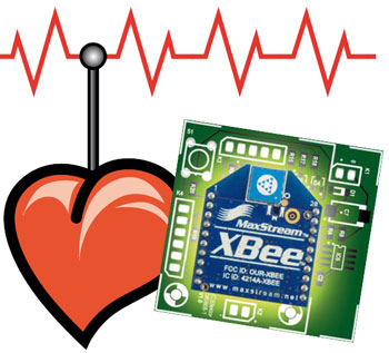 ECG sans fil