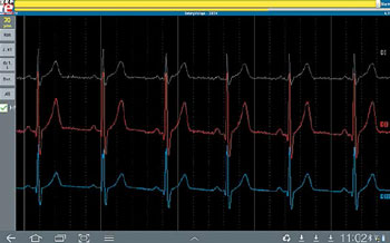 elektorcardioscope Android 1ère partie