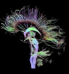 neurosciences cognitives et musique